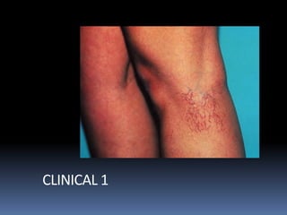 CLINICAL 1
 