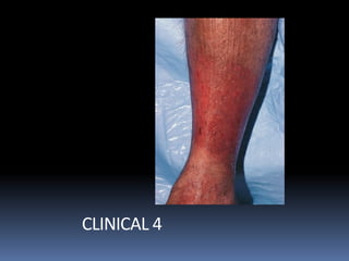 CLINICAL 4
 
