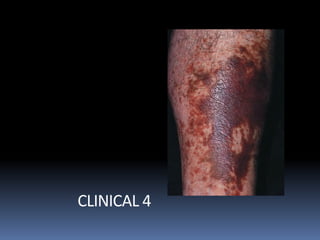 CLINICAL 4
 