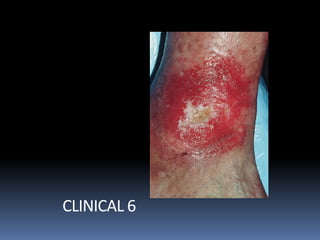 CLINICAL 6
 