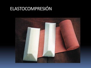 ELASTOCOMPRESIÓN
 