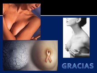 Patologia maligna de mama