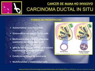  Asintomática –subclínica 80%.
 Sintomática con datos clínicos 20%
 Multicentricidad :CDIS en diferente
cuadrante con distancia > 4 cm
 96% de recurrencias ocurre en el mismo
cuadrante de la lesión primaria
 Condición es diferente cuadrante
 Multifocalidad y bilateralidad 10%
FORMAS DE PRESENTACION
CARCINOMA DUCTAL IN SITU
CANCER DE MAMA NO INVASIVO
American Society of Clinical Oncology (Sociedad Estadounidense de Oncología Clínica) 2318 Mill Road, www.asco.org | www.cancer.net.
 