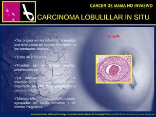 CARCINOMA LOBULILLAR IN SITU
Se origina en los lobulillos, a medida
que evoluciona en común la invasión a
los conductos vecinos.
Entre 40 y 50 años.
Pueden ser en ambas mamas,
predilección por CSE.
La adenosis esclerosante y la
mastopatía fibroquística pueden
degenerar en este tipo, y posterior a
carcinoma lobulillar infiltrante.
Mamografía: microcalcificaciones
agrupadas de varios tamaños y de
formas irregulares.
CANCER DE MAMA NO INVASIVO
5 –10%
American Society of Clinical Oncology (Sociedad Estadounidense de Oncología Clínica) 2318 Mill Road, www.asco.org | www.cancer.net.
 
