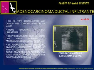 ADENOCARCINOMA DUCTAL INFILTRANTE
 ES EL TIPO HISTOLOGICO MAS
COMUN DEL CANCER INVASOR DE
MAMA.
 TIENE TENDENCIA A SER
UNILATERAL.
 SE PRESENTA CASI SIEMPRE COMO
UNA MASA PALPABLE O
ANORMALIDADES MAMOGRÁFICA.
 EL ADENOCARCINOMA DUCTAL NO
INVASIVO (CARCINOMA DUCTAL IN
SITU O CARCINOMA INTRADUCTAL)
SUELE APARECER SIN FORMAR UNA
MASA DEBIDO A QUE CARECE DEL
COMPONENTE ESCIRRO.
ECOGRAFIA MAMARIA
CARCINOMA DUCTAL
CANCER DE MAMA INVASIVO
70 –80%
American Society of Clinical Oncology (Sociedad Estadounidense de Oncología Clínica) 2318 Mill Road, www.asco.org | www.cancer.net.
 