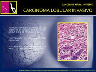 CARCINOMA LOBULAR INVASIVO
 APROXIMADAMENTE LA MITAD DE LOS
CASOS DE CA LOBULAR SON IN SITU SIN
NINGUN SIGNO DE INVASION LOCAL.
 REPRESENTA EL 2DO CANCER MAS
FRECUENTE.
 SE ASOCIA CON UN INCREMENTO DEL
RIESGO DE CANCER DE MAMA BILATERAL.
CANCER DE MAMA INVASIVO
American Society of Clinical Oncology (Sociedad Estadounidense de Oncología Clínica) 2318 Mill Road, www.asco.org | www.cancer.net.
 