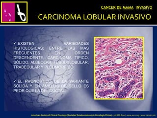 CARCINOMA LOBULAR INVASIVO
CANCER DE MAMA INVASIVO
 EXISTEN VARIEDADES
HISTOLOGICAS; ENTRE LAS MAS
FRECUENTES EN ORDEN
DESCENDENTE, CARCINOMA TIPICO,
SÓLIDO, ALBEOLAR, TUBULOLOBULAR,
TRABECULAR Y PLEOMORFICO.
 EL PRONOSTICO DE LA VARIANTE
SÓLIDA Y EN ANILLOS DE SELLO ES
PEOR QUE LA DEL DUCTAL.
American Society of Clinical Oncology (Sociedad Estadounidense de Oncología Clínica) 2318 Mill Road, www.asco.org | www.cancer.net.
 