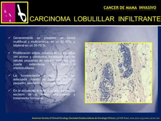 CARCINOMA LOBULILLAR INFILTRANTE
CANCER DE MAMA INVASIVO
 Generalmente se presenta de forma
multifocal y multicéntrica, en un 60-85%, y
bilateral en un 35-70 %.
 Proliferación sólida, oclusiva en los lobulillos
(en acinos y conductos intralobulillares) de
células pequeñas de tamaño uniforme, que
puede extenderse a conductos
interlobulillares
 La tumorectomía aislada puede ser
adecuada cuando se trata de un foco
pequeño, asociado a microcalcificación.
 En la actualidad lo mas aceptado es realizar
escisión de la lesión, seguimiento y
tratamiento hormonal.
American Society of Clinical Oncology (Sociedad Estadounidense de Oncología Clínica) 2318 Mill Road, www.asco.org | www.cancer.net.
 