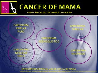 TIPOS ESPECIALES CON PRONOSTICO BUENO
CARCINOMA
PAPILAR
PURO
CARCINOMA
MEDULAR
TIPICO
CARCINOMA
MUCINOSO
CARCINOMA
TUBULAR
CARCINOMA
ADENOQUISTICO
ÉSTOS REPRESENTAN EL 10% DE LOS CA DE MAMA
American Society of Clinical Oncology (Sociedad Estadounidense de Oncología Clínica) 2318 Mill Road, www.asco.org | www.cancer.net.
 
