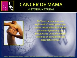 El Cáncer de mama es una
enfermedad heterogénea que
crece a velocidades distintas en
pacientes diferentes y con
frecuencia es una enfermedad
sistémica en el momento del
diagnostico inicial.
Rosen PP. Benign mesenchymal neoplasms, In: Rosen PP, editor.Rosen’s breast pathology. 2nd ed. Philadelphia: Lippincott Williams & Wilkins; 2001. p 775–777. 7.
 