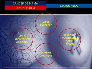CANCER DE MAMA
DIAGNOSTICO
EXAMEN FISICO
MASA
PALPABLE
DESCARGA
ESPONTANEA
POR EL
PEZON
CAMBIOS
CUTANEOS
LINFA
DENOPATIAS
AXILARES
Rosen PP. Benign mesenchymal neoplasms, In: Rosen PP, editor.Rosen’s breast pathology. 2nd ed. Philadelphia: Lippincott Williams & Wilkins; 2001. p 775–777. 7.
 