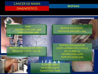 CANCER DE MAMA
DIAGNOSTICO
BIOPSIAS
PAAF
SENSIBILIDAD 90% - 95%
ESPECIFICIDAD 98%
BIOPSIA ESCISIONAL
(AGUJA DE ANCLAJE – 20g
BIOPSIA CONAGUJA DE
CORTE-ASPIRACION (CANULA
DE CALIBRE 11)
SENSIBILIDAD 100%
ESPECIFICADAD 90%
BIOPSIA CONAGUJA DE CORTE
(AGUJA DE CORTE – cal. 18)
ESTEREOTAXIA
Sensibilidad: 97%.
Especificidad: 100%
 