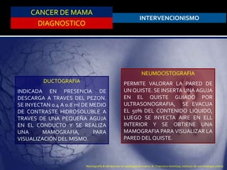 CANCER DE MAMA
DIAGNOSTICO
INTERVENCIONISMO
DUCTOGRAFIA
INDICADA EN PRESENCIA DE
DESCARGA A TRAVES DEL PEZON.
SE INYECTAN 0.4 A 0.8 ml DE MEDIO
DE CONTRASTE HIDROSOLUBLE A
TRAVES DE UNA PEQUEÑA AGUJA
EN EL CONDUCTO Y SE REALIZA
UNA MAMOGRAFIA, PARA
VISUALIZACIÓN DEL MISMO.
NEUMOCISTOGRAFIA
PERMITE VALORAR LA PARED DE
UN QUISTE. SE INSERTA UNA AGUJA
EN EL QUISTE GUIADO POR
ULTRASONOGRAFIA, SE EVACUA
EL 50% DEL CONTENIDO LIQUIDO,
LUEGO SE INYECTA AIRE EN ELL
INTERIOR Y SE OBTIENE UNA
MAMOGRAFIA PARA VISUALIZAR LA
PARED DEL QUISTE.
Mamografía & ultrasonido en patología de mama, dr. Francisco montoya, instituto de cancerologia colima
 