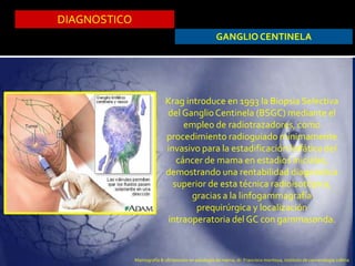 DIAGNOSTICO
GANGLIO CENTINELA
Krag introduce en 1993 la Biopsia Selectiva
del GanglioCentinela (BSGC) mediante el
empleo de radiotrazadores, como
procedimiento radioguiado mínimamente
invasivo para la estadificación linfática del
cáncer de mama en estadios iniciales,
demostrando una rentabilidad diagnóstica
superior de esta técnica radioisotópica,
gracias a la linfogammagrafía
prequirúrgica y localización
intraoperatoria del GC con gammasonda.
Mamografía & ultrasonido en patología de mama, dr. Francisco montoya, instituto de cancerologia colima
 