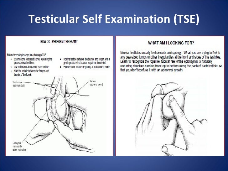 Patologi Testis