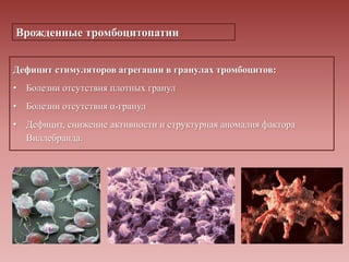 Врожденные тромбоцитопатии
Дефицит стимуляторов агрегации в гранулах тромбоцитов:
• Болезни отсутствия плотных гранул
• Болезни отсутствия α-гранул
• Дефицит, снижение активности и структурная аномалия фактора
Виллебранда.
 