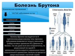 Болезнь Брутона
Клинические проявления
ЧАСТЫЕ заболевания за год
ПНЕВМОНИЯ
отиты
синуситы
сепсис
менингит
Болезнь Брутона наследуется по Х-
сцепленному рецессивному типу: признаки
заболевания выявляются только у мальчиков
(набор половых хромосом XY). Девочки не
болеют, так как даже если они гетерозиготны, то
рецессивный ген одной X-
хромосомы компенсируется нормальным геном
гомологичной X-хромосомы. Болезнь встречается
среди мальчиков с частотой 1:25000
 