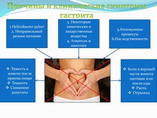 1.Helicobacter pylori
2. Неправильный
режим питания
3. Некоторые
химические и
лекарственные
вещества
4. Алкоголь и
никотин
5.Атоимунные
процессы
6.Наследственность
 Тяжесть в
животе после
приема пищи
 Тошнота
 Снижение
аппетита
 Боли в верхней
части живота
натощак или
после еды
 Рвота
 Отрыжка
 