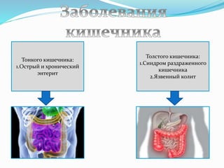 Тонкого кишечника:
1.Острый и хронический
энтерит
Толстого кишечника:
1.Синдром раздраженного
кишечника
2.Язвенный колит
 