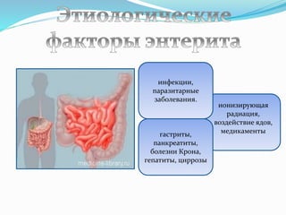 ионизирующая
радиация,
воздействие ядов,
медикаменты
инфекции,
паразитарные
заболевания.
гастриты,
панкреатиты,
болезни Крона,
гепатиты, циррозы
 
