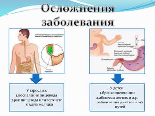 У взрослых:
1.воспаление пищевода
2.рак пищевода или верхнего
отдела желудка
У детей:
1.бронхопневмонии
2.абсцессы легких и д.р.
заболевания дыхательных
путей
 