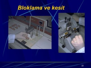 22
Bloklama ve kesit
 