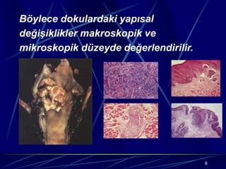 6
Böylece dokulardaki yapısal
değişiklikler makroskopik ve
mikroskopik düzeyde değerlendirilir.
 