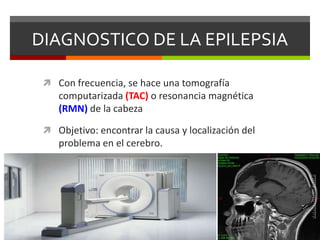 DIAGNOSTICO DE LA EPILEPSIA
 Con frecuencia, se hace una tomografía

computarizada (TAC) o resonancia magnética
(RMN) de la cabeza
 Objetivo: encontrar la causa y localización del

problema en el cerebro.

 