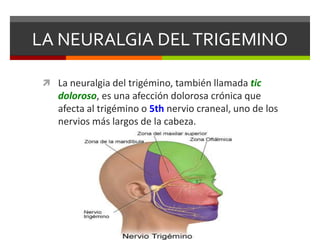 LA NEURALGIA DEL TRIGEMINO
 La neuralgia del trigémino, también llamada tic

doloroso, es una afección dolorosa crónica que
afecta al trigémino o 5th nervio craneal, uno de los
nervios más largos de la cabeza.

 