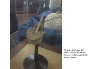Vértebra perfurada por
flecha. Acervo: Museu do
Homem do Sambaqui. Foto:
Renato Hexsel.
 