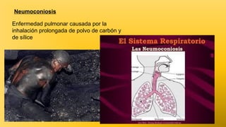 Neumoconiosis
Enfermedad pulmonar causada por la
inhalación prolongada de polvo de carbón y
de sílice

 