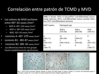 Tcmd Worksheet EL PATRON DE REALCE EN TCMD DE LOS TUMORES ENDOCRINOS PANCREATICOS ...
