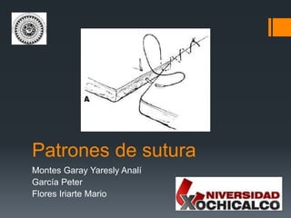 Patrones de sutura
Montes Garay Yaresly Analí
García Peter
Flores Iriarte Mario
 