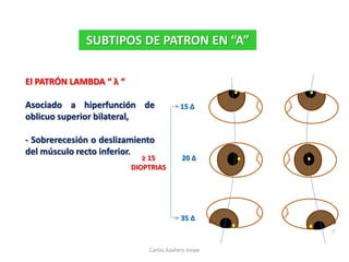 El PATRÓN LAMBDA “ λ “
Asociado a hiperfunción de
oblicuo superior bilateral,
- Sobrerecesión o deslizamiento
del músculo recto inferior.
SUBTIPOS DE PATRON EN “A”
20 Δ
15 Δ
35 Δ
≥ 15
DIOPTRIAS
Carlos Azañero Inope
 