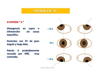 PATRON EN “X”
El PATRÓN “ X “
Divergencia en supra e
infraversión sin causa
específica.
Pacientes con XT de gran
ángulo y larga data.
Patrón X probablemente
causado por MRL muy
contraído.
30 Δ
40 Δ
40 Δ
Carlos Azañero Inope
 