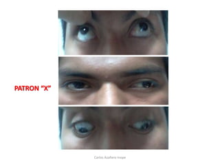 Carlos Azañero Inope
PATRON “X”
 