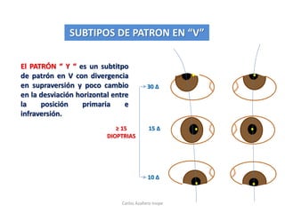 El PATRÓN “ Y “ es un subtitpo
de patrón en V con divergencia
en supraversión y poco cambio
en la desviación horizontal entre
la posición primaria e
infraversión.
SUBTIPOS DE PATRON EN “V”
15 Δ
30 Δ
10 Δ
≥ 15
DIOPTRIAS
Carlos Azañero Inope
 