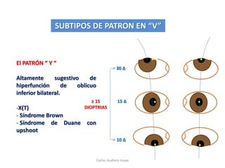 El PATRÓN “ Y “
Altamente sugestivo de
hiperfunción de oblicuo
inferior bilateral.
-X(T)
- Síndrome Brown
- Síndrome de Duane con
upshoot
SUBTIPOS DE PATRON EN “V”
15 Δ
30 Δ
10 Δ
≥ 15
DIOPTRIAS
Carlos Azañero Inope
 