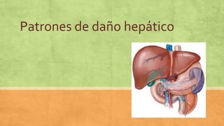 Patrones de daño hepático
 