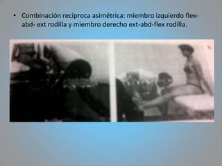 • Combinación reciproca asimétrica: miembro izquierdo flex-
  abd- ext rodilla y miembro derecho ext-abd-flex rodilla.
 