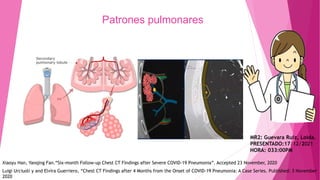 Patrones pulmonares
MR2: Guevara Ruiz, Loida.
PRESENTADO:17/12/2021
HORA: 033:00PM
Xiaoyu Han, Yanqing Fan.“Six-month Follow-up Chest CT Findings after Severe COVID-19 Pneumonia”. Accepted 23 November, 2020
Luigi Urciuoli y and Elvira Guerriero, “Chest CT Findings after 4 Months from the Onset of COVID-19 Pneumonia: A Case Series. Published: 3 November
2020
 