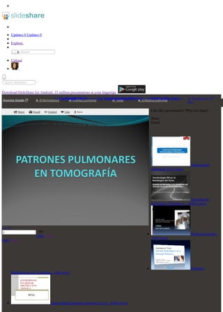 Updates 0 Updates 0
EnviarSearch
Upload
Search SlideShare
Download SlideShare for Android. 15 million presentations at your ﬁngertips
Explore
×
Like this presentation? Why not share!
Share
Email
Enfermedad
pulmonar 1024 views
Sociedad de
Fleischner: Glosario d... 18451 views
Pulmon terminos
1197 views
Patrones
Radiológicos en la Patolog... 108 views
Enfermedad pulmonar obstructiva cró... 8494 views
Anuncios Google ► Enfermedades ► Fibrosis pulmonar ► Torax ► Enfisema pulmonar
Share Email Embed Like Save
1
« ‹ › »
/84
Like Share
Like Share
by Yuri pe? by Residencia CT
Sca...
by imagenescastexby Horizonte APS by kamikase47by GASPAR-ALBERTO MO...by Alejandro Zamudio...by USFQby Universidad Tecno...by Tano Cabriniby Paco Rby Paco R
 