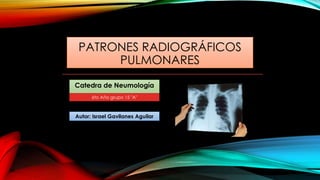 PATRONES RADIOGRÁFICOS
PULMONARES
Catedra de Neumología
Autor: Israel Gavilanes Aguilar
6to Año grupo 15 "A"
 