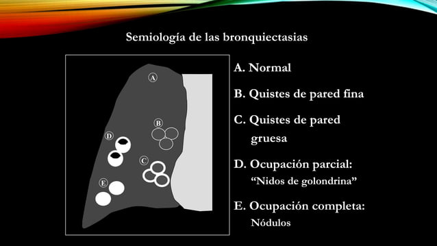 Patrones radiográficos pulmonares rx tcar | PPT