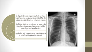Si el pulmón está hiperinsuflado se hace
hiperlucente, ya que una cantidad fija de
tejido se expande en un volumen mayor.
Si el intersticio se el pulmón se hace más
hiperlucente porque hay menos tejido
para absorber la radiación.
Las bulas o la escasa trama reemplazan a
la ramificación vascular normal.
 