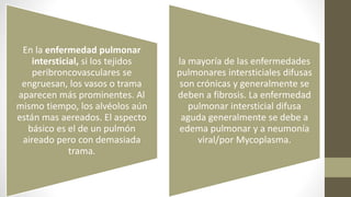 En la enfermedad pulmonar
intersticial, si los tejidos
peribroncovasculares se
engruesan, los vasos o trama
aparecen más prominentes. Al
mismo tiempo, los alvéolos aún
están mas aereados. El aspecto
básico es el de un pulmón
aireado pero con demasiada
trama.
la mayoría de las enfermedades
pulmonares intersticiales difusas
son crónicas y generalmente se
deben a fibrosis. La enfermedad
pulmonar intersticial difusa
aguda generalmente se debe a
edema pulmonar y a neumonía
viral/por Mycoplasma.
 