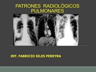 PATRONES RADIOLÓGICOS
PULMONARES
INT. FABRICIO SILES PEREYRA
 
