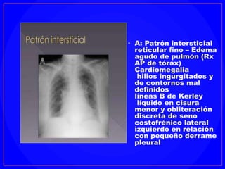 RADIOLOGIA - Patrones radiologicos del torax radiopacos. | PPTX