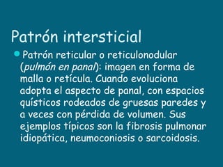 Patrones radiologicos pulmonares | PPT