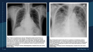 10cm 12
Ref X-Ray Exp /
 